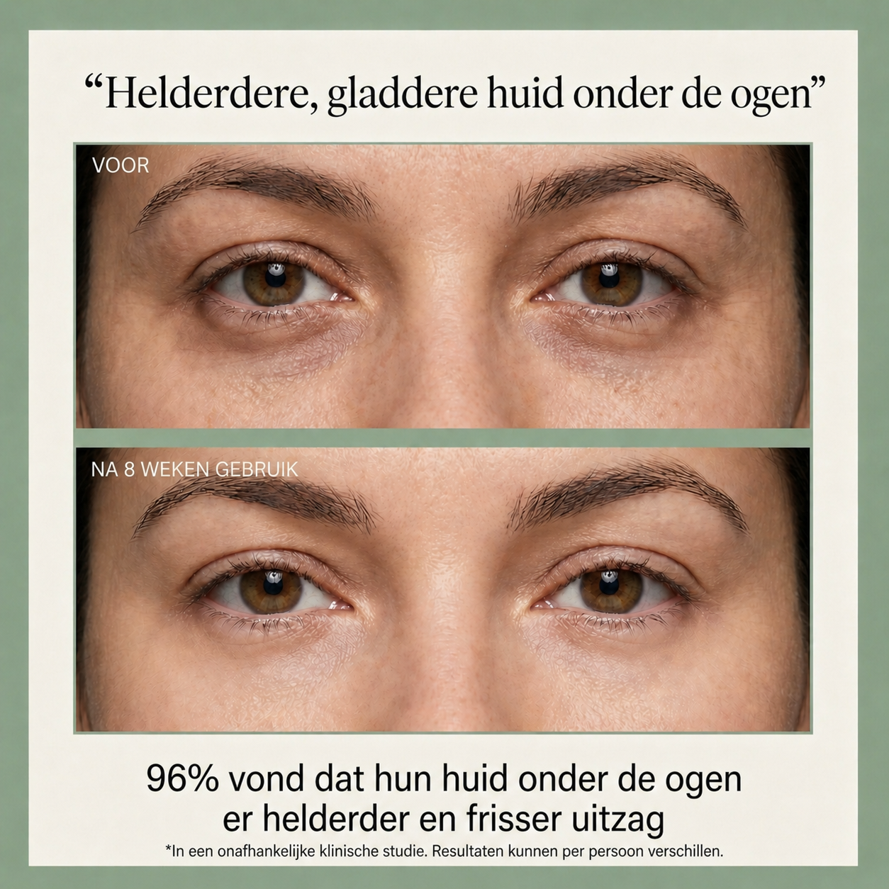 18-Kruiden Verrijkt Onder-Oog Revival Serum met Zoethoutwortel & Peptiden voor Helderdere, Stevigere Onderogen